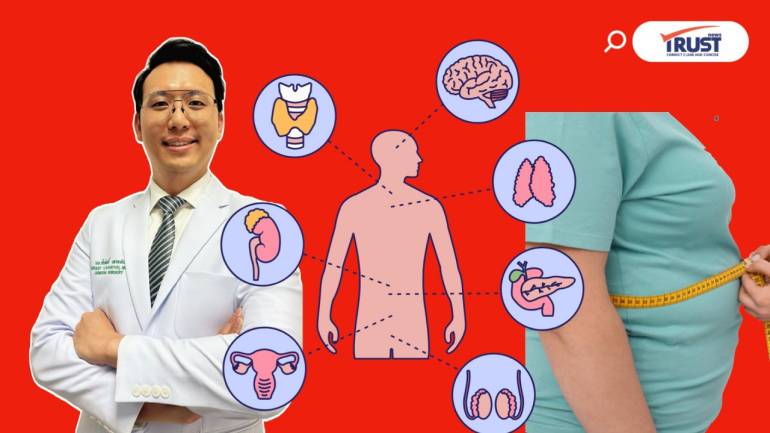9 ข้อรู้จักโรคอ้วนมากขึ้น วิจัยชี้อายุขัยสั้นลง 14 ปี 
