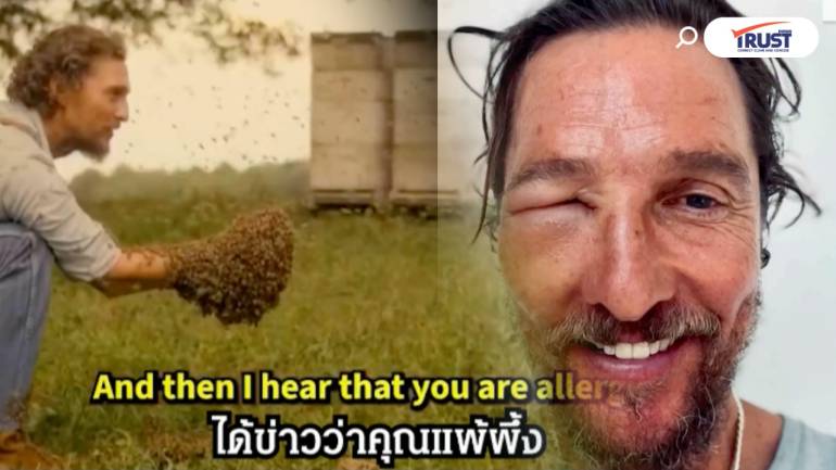 เล่นจริงเจ็บจริง! “แม็กคอนาเฮย์” หน้าบวม โดนผึ้งต่อยจนแพ้
